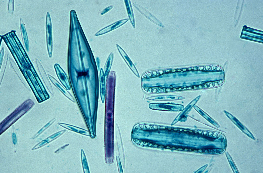 an assortment of diatoms with different shaped glass shells, some are rectangular and some are rounded in the middle narrowing to a tip on the top and bottom