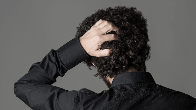 a photo of a person with short curly hair scratching their head, as seen from behind. White flakes of dandruff are visible on the collar and shoulders of their black dress shirt.