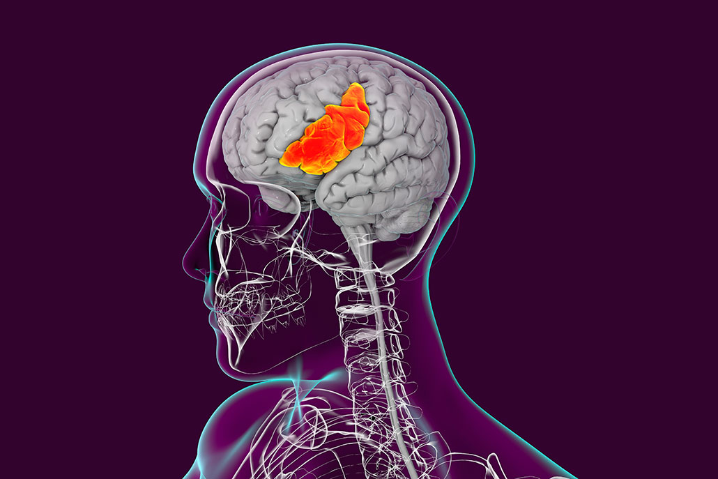 an illustration showing where the Broca's area is located in the human brain