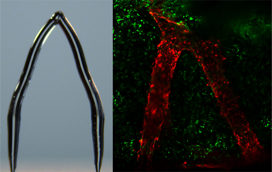 a composite image showing a printed ice template on the left in an upside down v shappe, and a corresponding blood vessel shaped the same way on the right